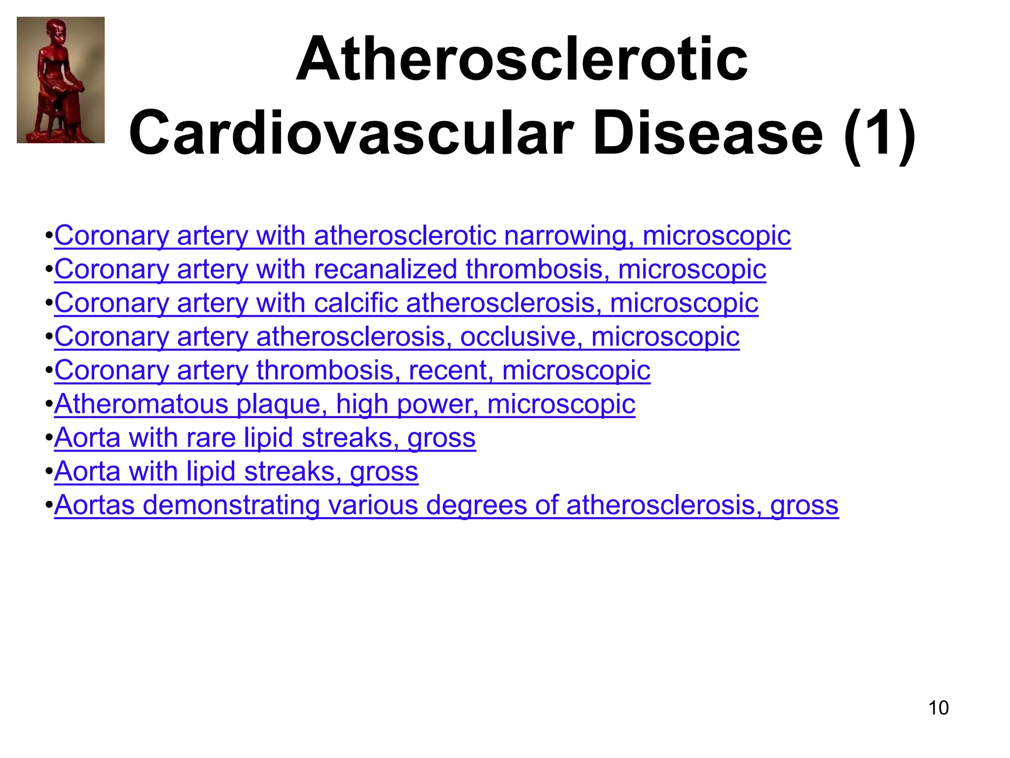 Atherosclerotic
Cardiovascular Disease (1)
•Coronary artery with atherosclerotic narrowing, microscopic
•Coronary artery with recanalized thrombosis, microscopic
•Coronary artery with calcific atherosclerosis, microscopic
•Coronary artery atherosclerosis, occlusive, microscopic
•Coronary artery thrombosis, recent, microscopic
•Atheromatous plaque, high power, microscopic
•Aorta with rare lipid streaks, gross
•Aorta with lipid streaks, gross
•Aortas demonstrating various degrees of atherosclerosis, gross

10

 