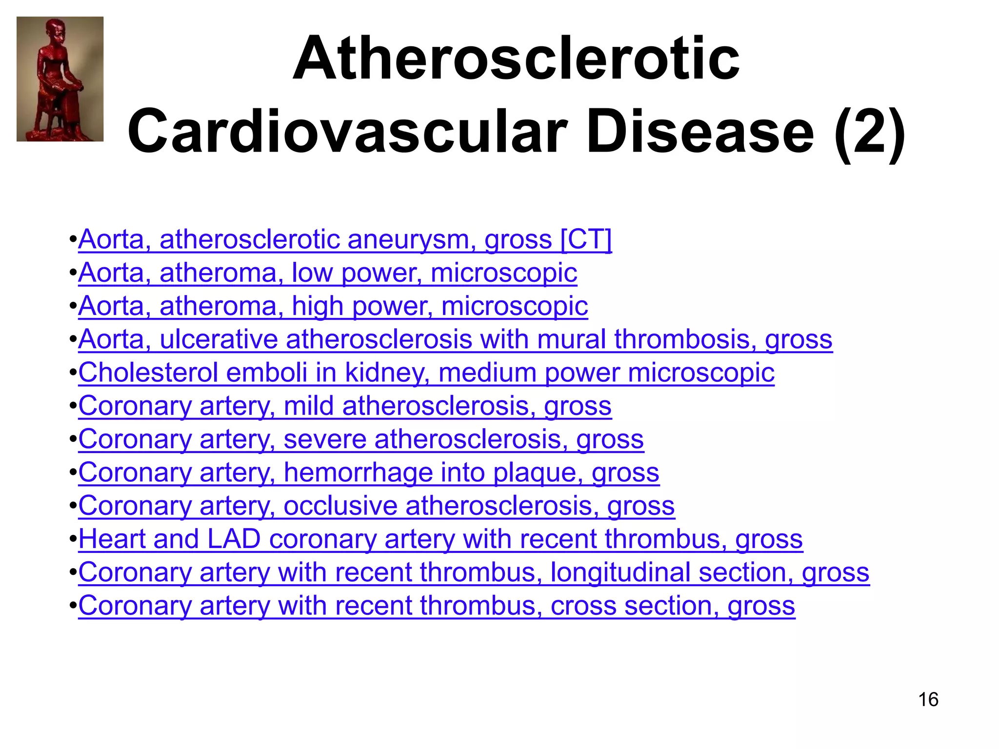 Atherosclerotic
Cardiovascular Disease (2)
•Aorta, atherosclerotic aneurysm, gross [CT]
•Aorta, atheroma, low power, microscopic
•Aorta, atheroma, high power, microscopic
•Aorta, ulcerative atherosclerosis with mural thrombosis, gross
•Cholesterol emboli in kidney, medium power microscopic
•Coronary artery, mild atherosclerosis, gross
•Coronary artery, severe atherosclerosis, gross
•Coronary artery, hemorrhage into plaque, gross
•Coronary artery, occlusive atherosclerosis, gross
•Heart and LAD coronary artery with recent thrombus, gross
•Coronary artery with recent thrombus, longitudinal section, gross
•Coronary artery with recent thrombus, cross section, gross

16

 