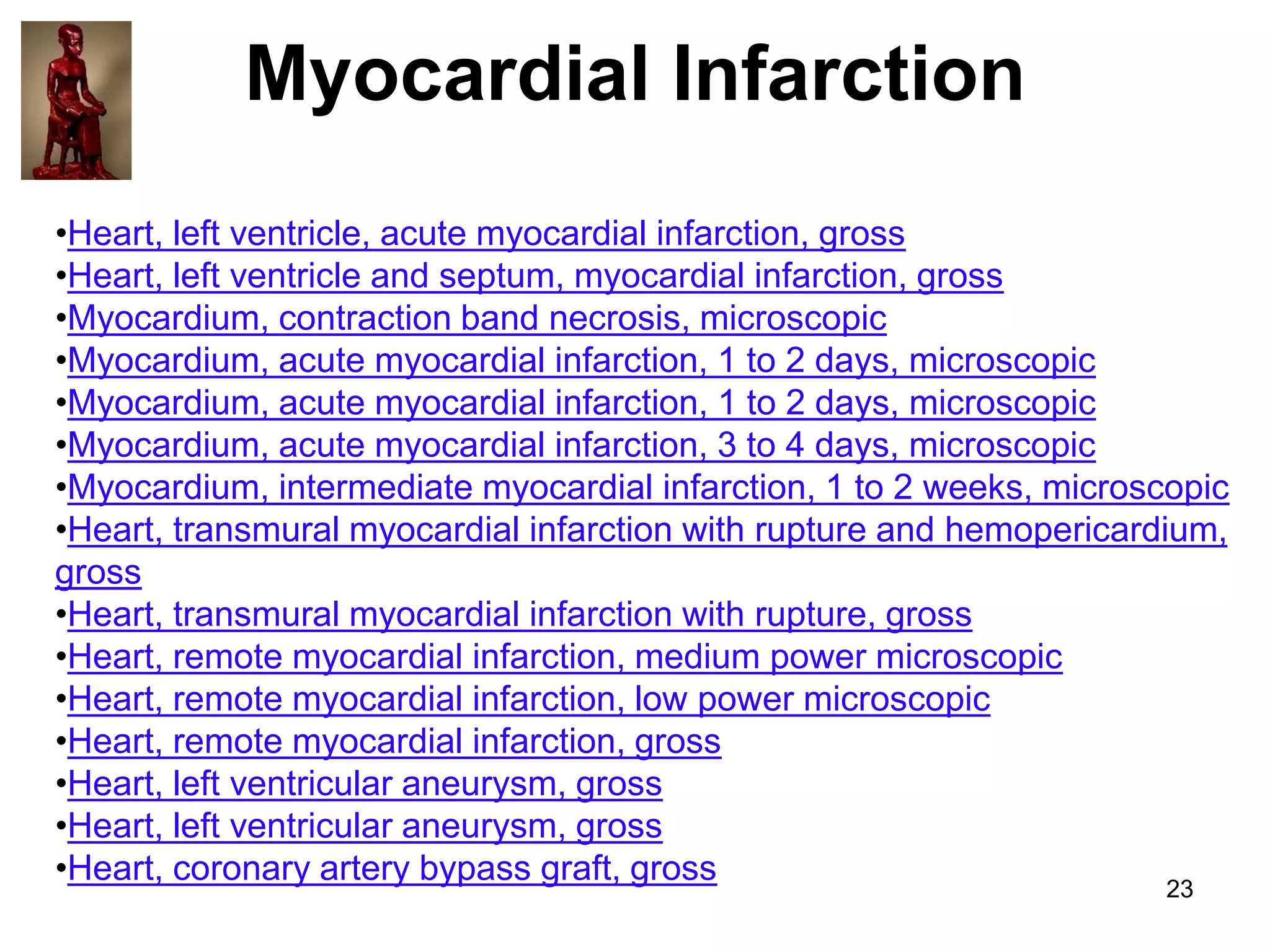 Myocardial Infarction
•Heart, left ventricle, acute myocardial infarction, gross
•Heart, left ventricle and septum, myocardial infarction, gross
•Myocardium, contraction band necrosis, microscopic
•Myocardium, acute myocardial infarction, 1 to 2 days, microscopic
•Myocardium, acute myocardial infarction, 1 to 2 days, microscopic
•Myocardium, acute myocardial infarction, 3 to 4 days, microscopic
•Myocardium, intermediate myocardial infarction, 1 to 2 weeks, microscopic
•Heart, transmural myocardial infarction with rupture and hemopericardium,
gross
•Heart, transmural myocardial infarction with rupture, gross
•Heart, remote myocardial infarction, medium power microscopic
•Heart, remote myocardial infarction, low power microscopic
•Heart, remote myocardial infarction, gross
•Heart, left ventricular aneurysm, gross
•Heart, left ventricular aneurysm, gross
•Heart, coronary artery bypass graft, gross
23

 
