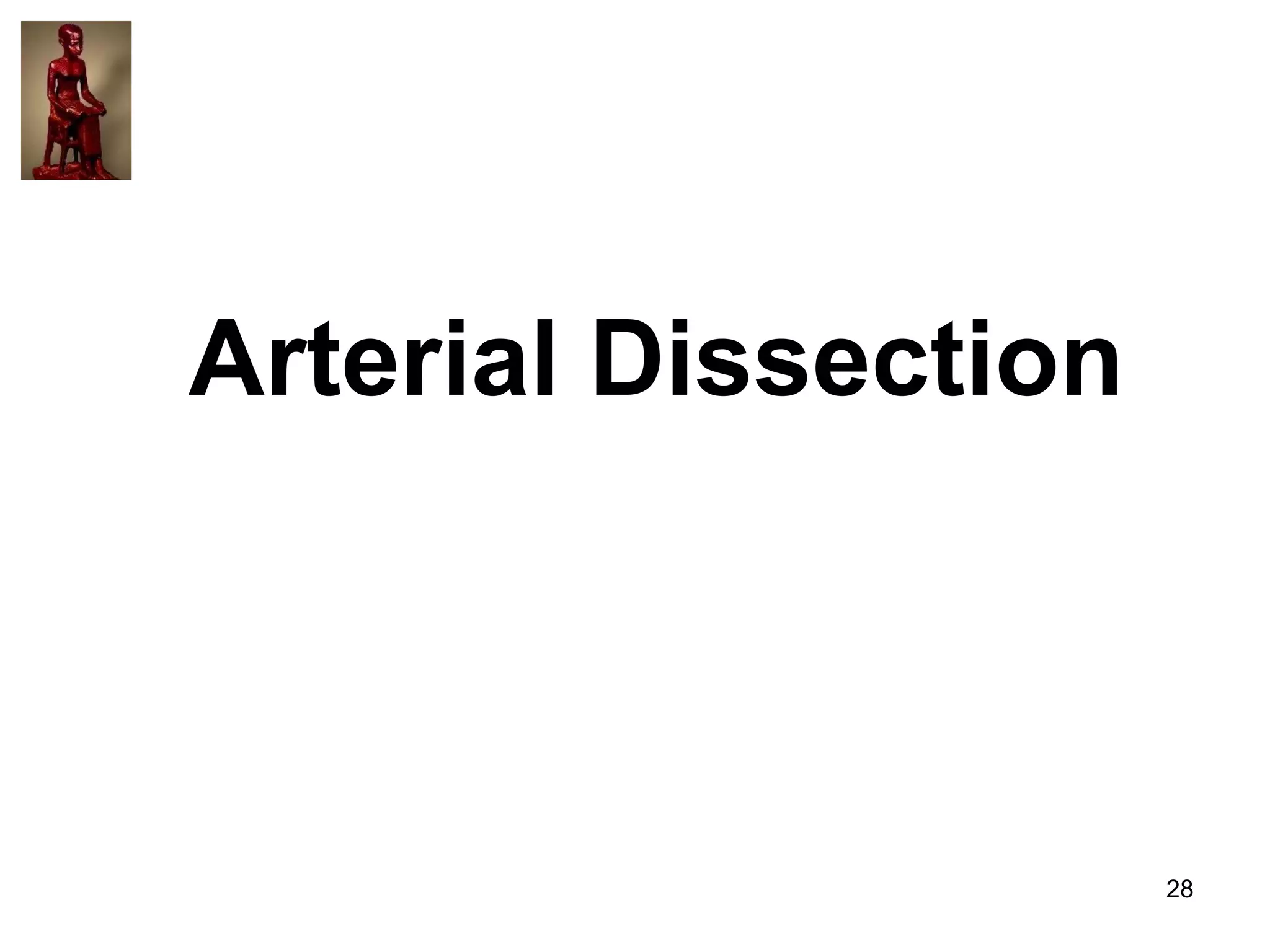 Arterial Dissection

28

 