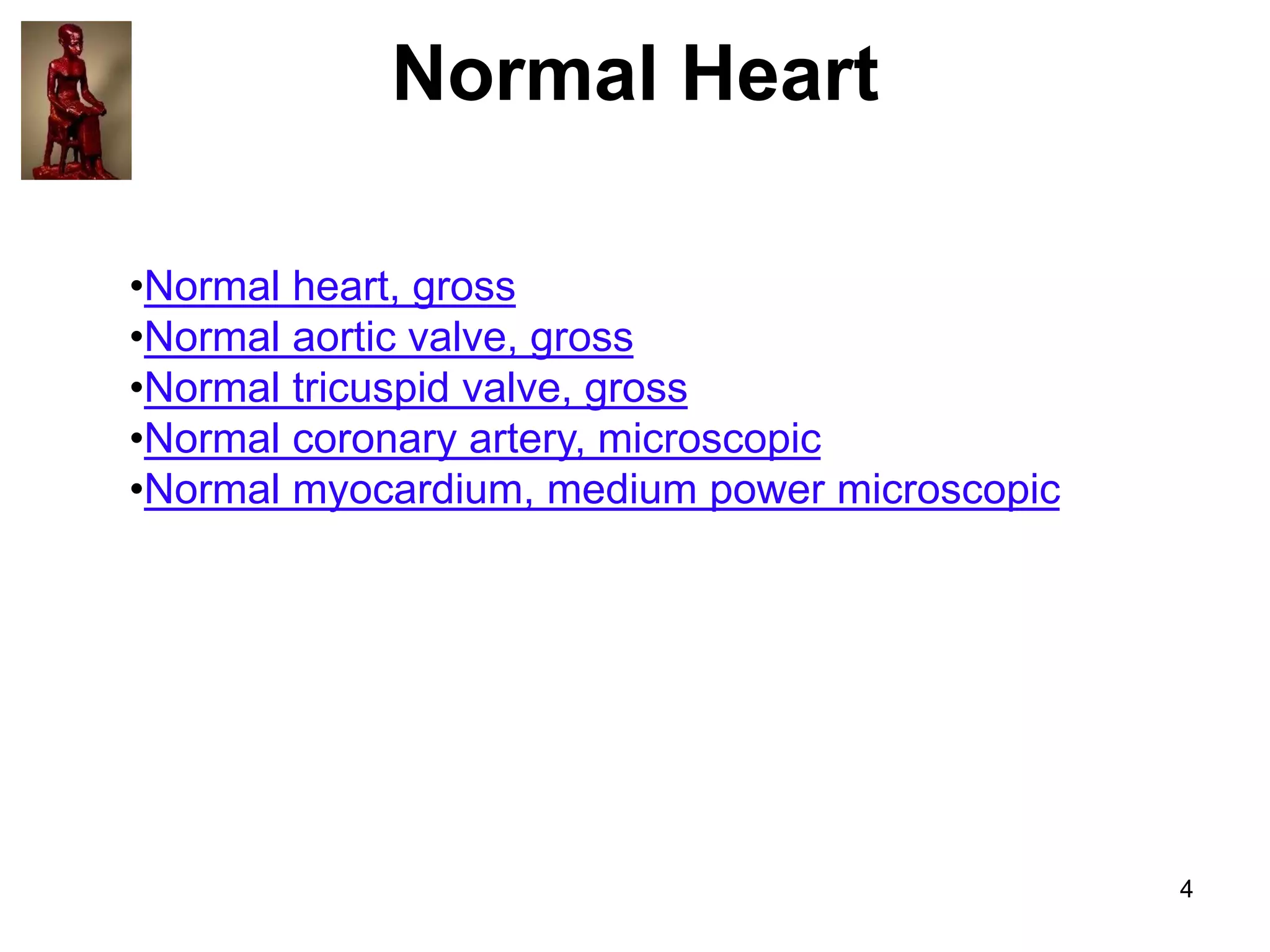 Normal Heart
•Normal heart, gross
•Normal aortic valve, gross
•Normal tricuspid valve, gross
•Normal coronary artery, microscopic
•Normal myocardium, medium power microscopic

4

 