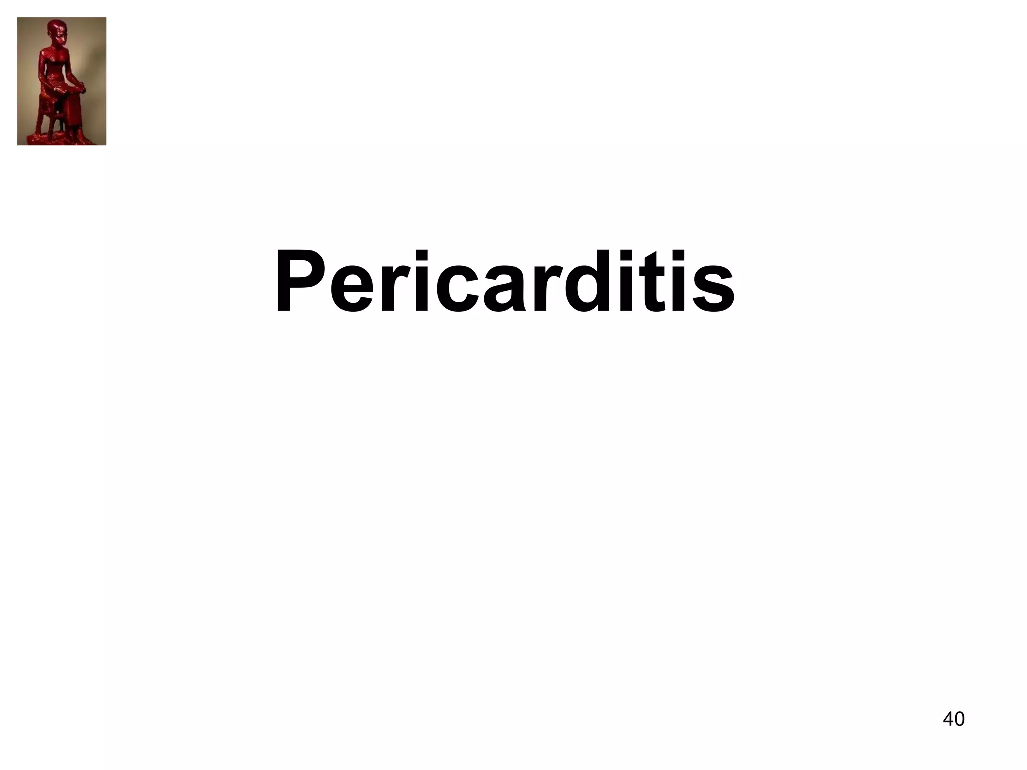 Pericarditis

40

 