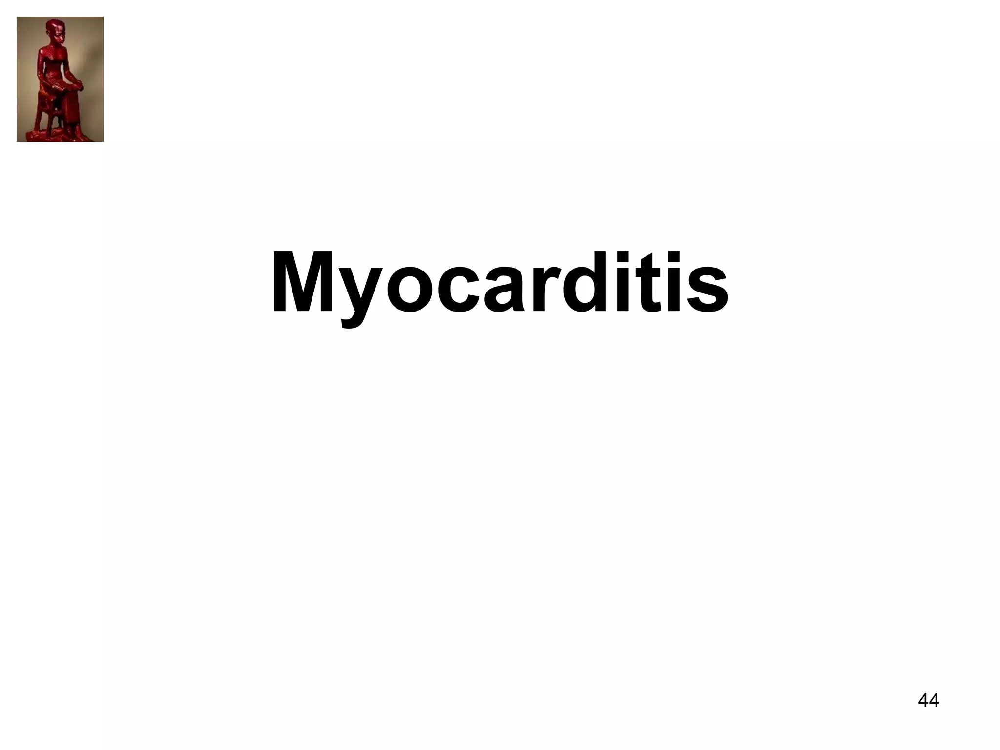 Myocarditis

44

 