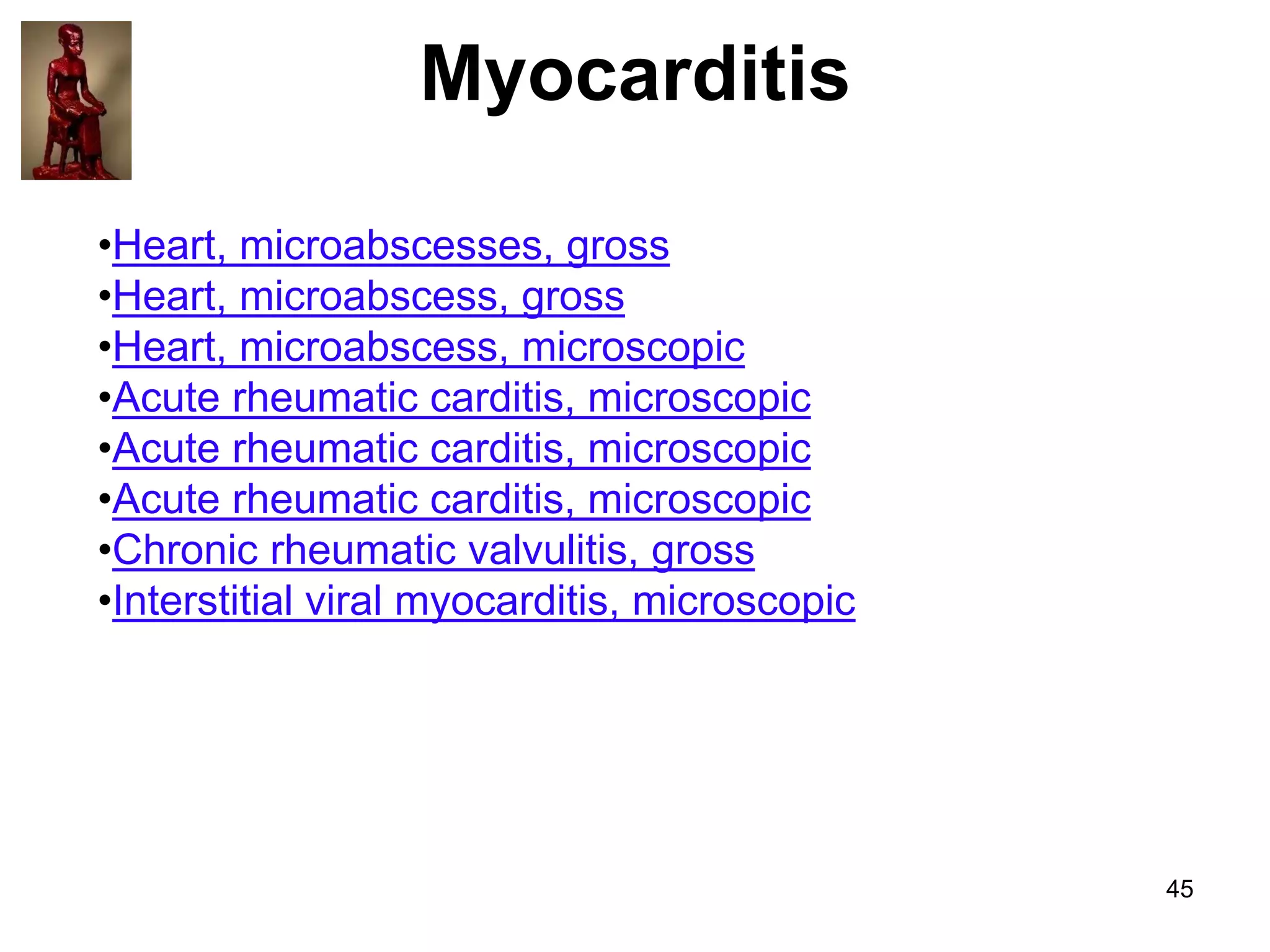 Myocarditis
•Heart, microabscesses, gross
•Heart, microabscess, gross
•Heart, microabscess, microscopic
•Acute rheumatic carditis, microscopic
•Acute rheumatic carditis, microscopic
•Acute rheumatic carditis, microscopic
•Chronic rheumatic valvulitis, gross
•Interstitial viral myocarditis, microscopic

45

 