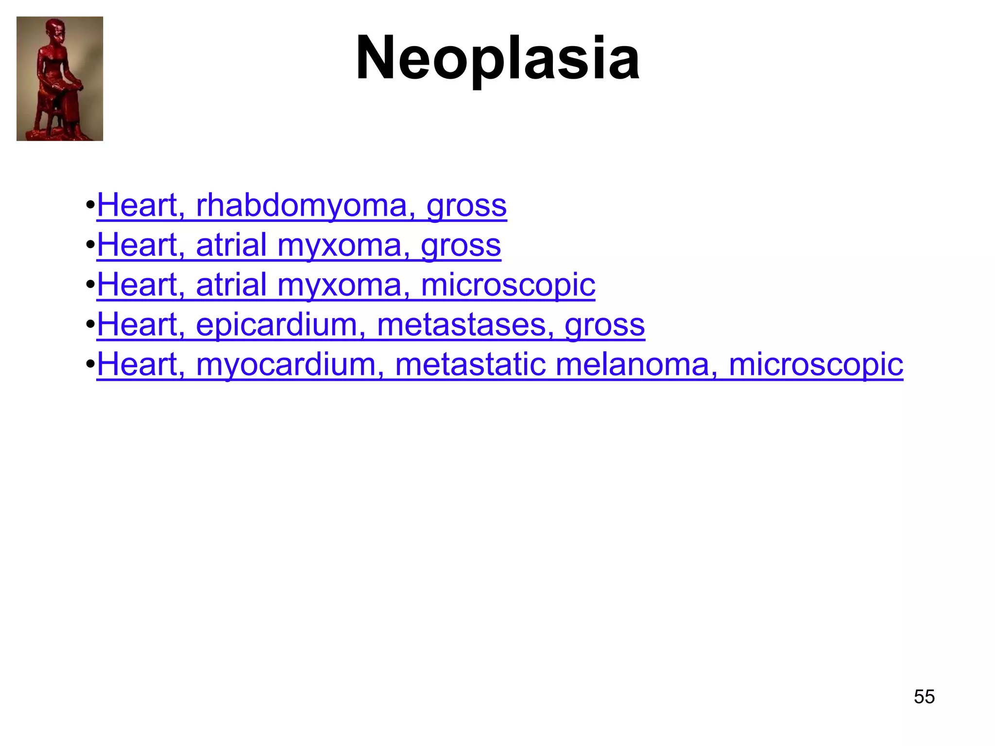 Neoplasia
•Heart, rhabdomyoma, gross
•Heart, atrial myxoma, gross
•Heart, atrial myxoma, microscopic
•Heart, epicardium, metastases, gross
•Heart, myocardium, metastatic melanoma, microscopic

55

 