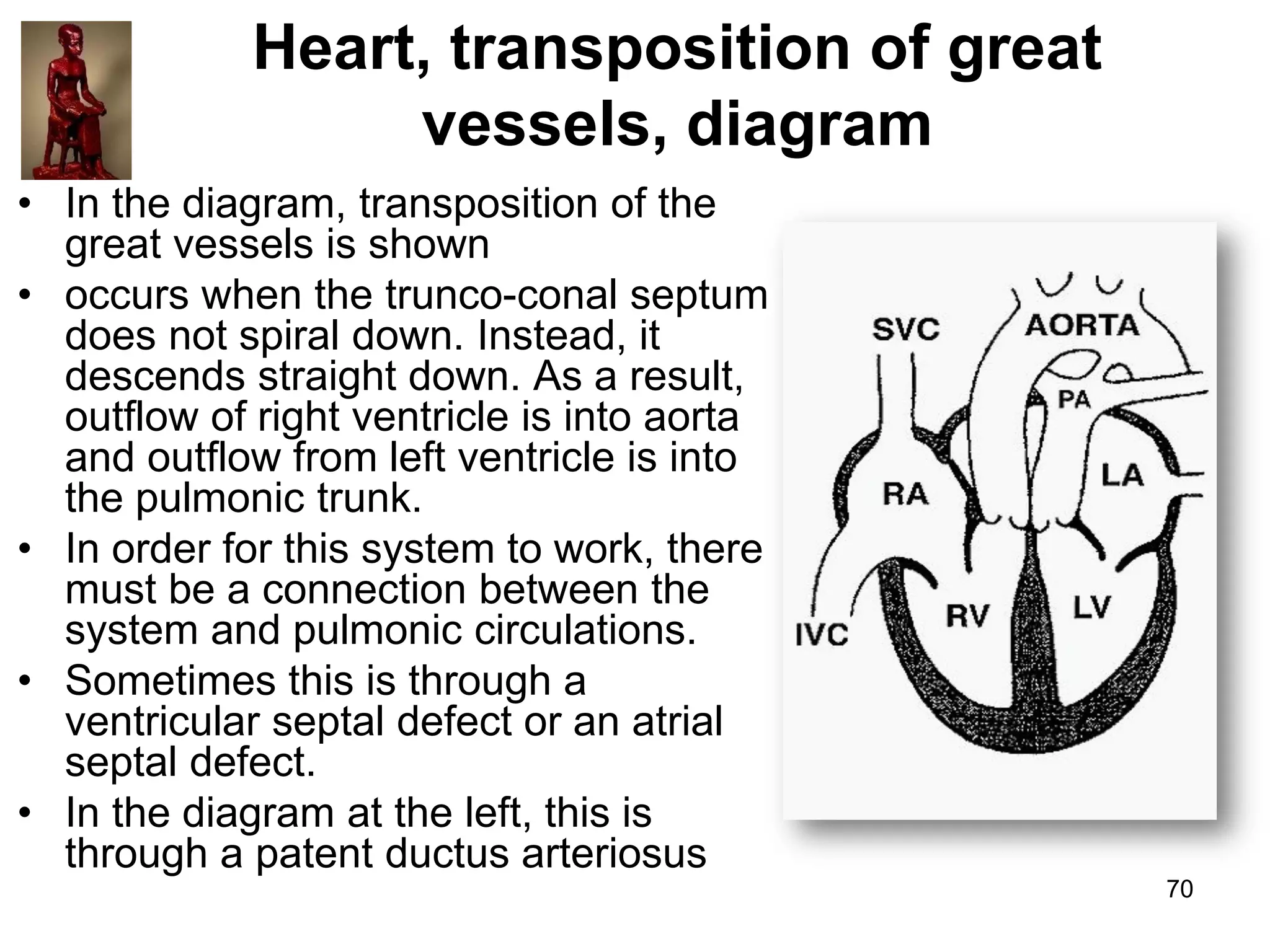Heart, transposition of great
vessels, diagram
• In the diagram, transposition of the
great vessels is shown
• occurs when the trunco-conal septum
does not spiral down. Instead, it
descends straight down. As a result,
outflow of right ventricle is into aorta
and outflow from left ventricle is into
the pulmonic trunk.
• In order for this system to work, there
must be a connection between the
system and pulmonic circulations.
• Sometimes this is through a
ventricular septal defect or an atrial
septal defect.
• In the diagram at the left, this is
through a patent ductus arteriosus
70

 