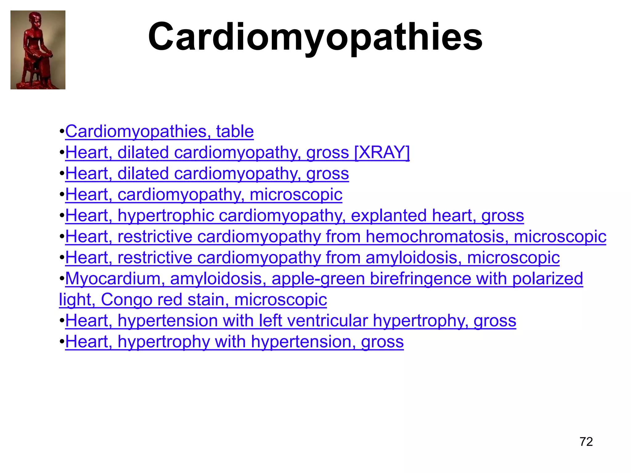 Cardiomyopathies
•Cardiomyopathies, table
•Heart, dilated cardiomyopathy, gross [XRAY]
•Heart, dilated cardiomyopathy, gross
•Heart, cardiomyopathy, microscopic
•Heart, hypertrophic cardiomyopathy, explanted heart, gross
•Heart, restrictive cardiomyopathy from hemochromatosis, microscopic
•Heart, restrictive cardiomyopathy from amyloidosis, microscopic
•Myocardium, amyloidosis, apple-green birefringence with polarized
light, Congo red stain, microscopic
•Heart, hypertension with left ventricular hypertrophy, gross
•Heart, hypertrophy with hypertension, gross

72

 