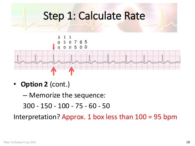 Ivms Cv Introduction To Ekg Intepretation Ivms Cv Introduction To Ekg Intepretation