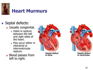Copyright © The McGraw-Hill Companies, Inc. Permission required for reproduction or display.
39
Heart Murmurs
 Septal def...