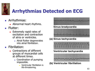 Copyright © The McGraw-Hill Companies, Inc. Permission required for reproduction or display.
63
Arrhythmias Detected on EC...