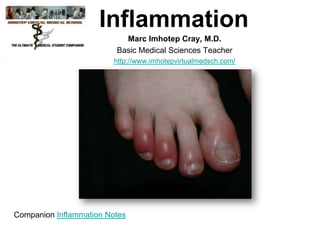 Inflammation
Marc Imhotep Cray, M.D.
Basic Medical Sciences Teacher
http://www.imhotepvirtualmedsch.com/

Companion Inflammation Notes

 
