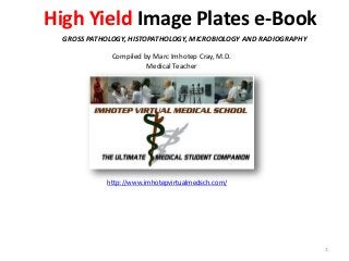 High Yield Image Plates e-Book
GROSS PATHOLOGY, HISTOPATHOLOGY, MICROBIOLOGY AND RADIOGRAPHY
Compiled by Marc Imhotep Cray, M.D.
Medical Teacher

http://www.imhotepvirtualmedsch.com/

1

 