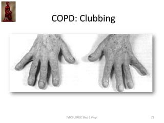 COPD: Clubbing
IVMS USMLE Step 1 Prep. 25
 
