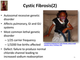Cystic Fibrosis(2)
• Autosomal recessive genetic
disorder
• Affects pulmonary, GI and GU
systems
• Most common lethal genetic
disorder
– 1/25 carrier frequency
– 1/3200 live births affected
• Defect: failure to produce normal
chloride channel leading to
increased sodium reabsorption 36
A breathing treatment for cystic fibrosis, using a mask
nebulizer and a ThAIRapy Vest
 