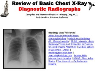 Review of Basic Chest X-Ray
Diagnostic Radiographs
Prepared and presented by
Marc Imhotep Cray, M.D.
BMS/CK Teacher
1
 