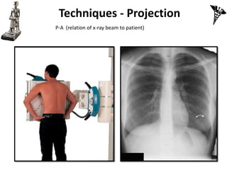 Basic CXR Interpretation_Diagnostic Radiography | PDF
