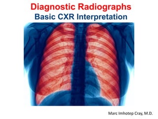 Diagnostic Radiographs
Basic CXR Interpretation
Marc Imhotep Cray, M.D.
 