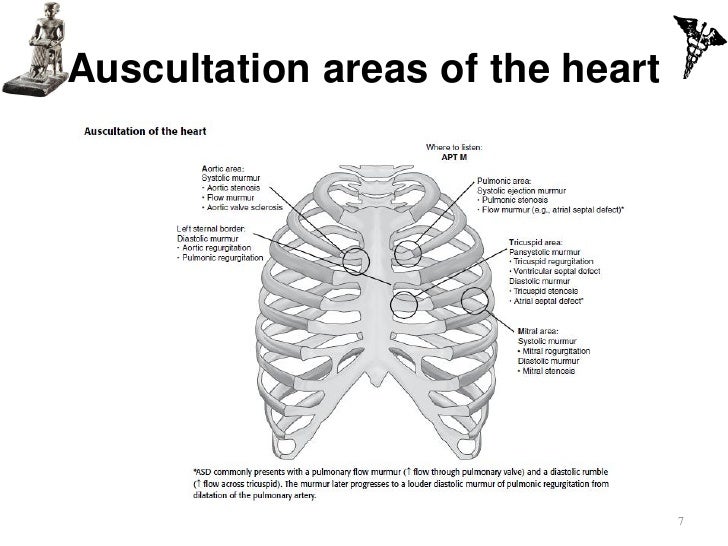 IVMS -ICM Heart Murmurs