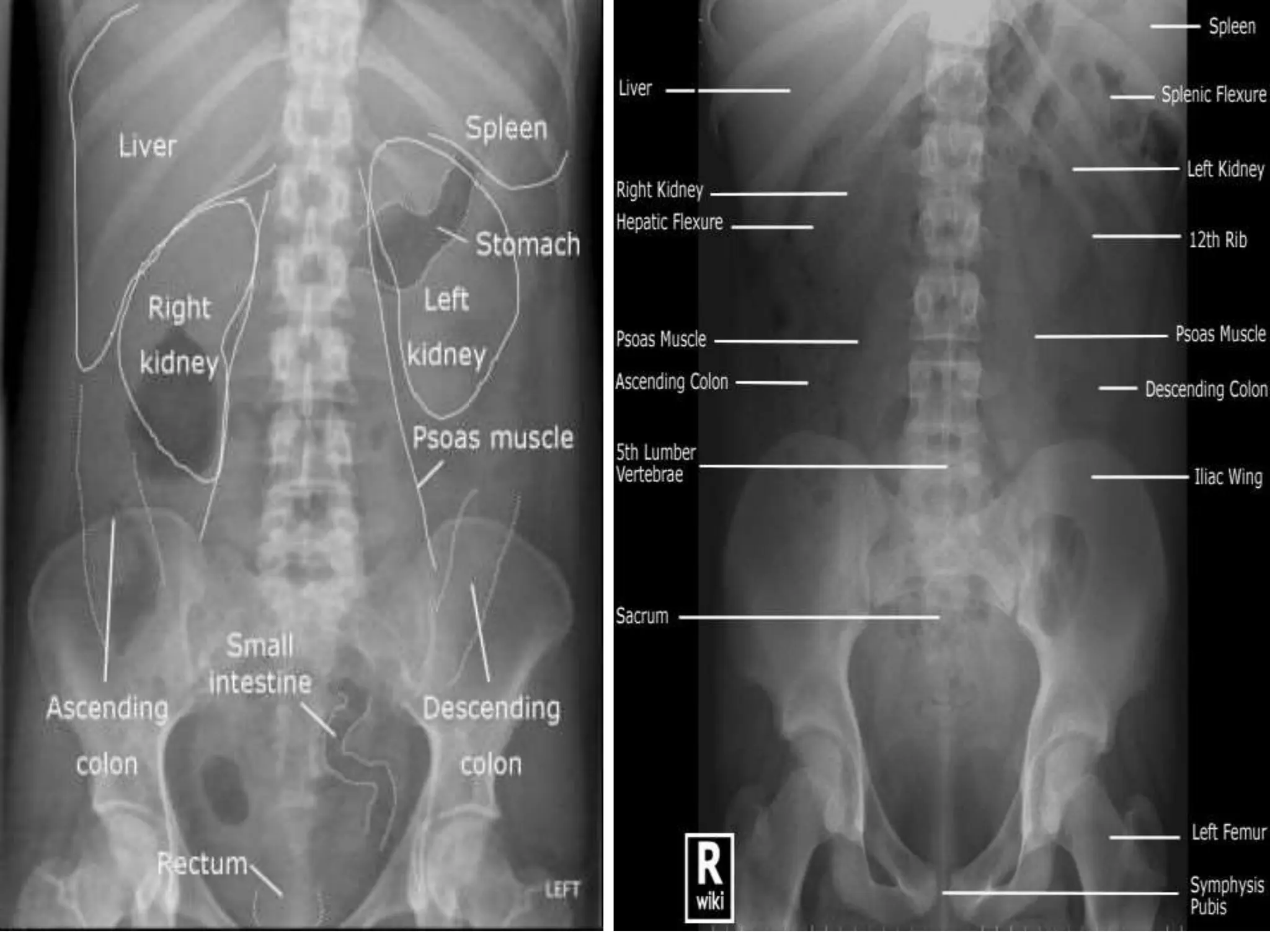 INTRAVENOUS UROGRAPHY INDICATIONS CONTRAINDICATIONS | PPTX