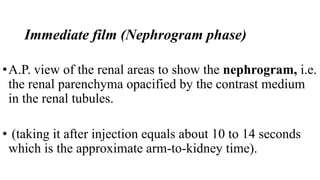 Immediate film (Nephrogram phase)
•A.P. view of the renal areas to show the nephrogram, i.e.
the renal parenchyma opacified by the contrast medium
in the renal tubules.
• (taking it after injection equals about 10 to 14 seconds
which is the approximate arm-to-kidney time).
 