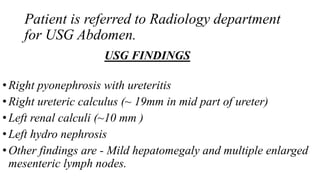 Patient is referred to Radiology department
for USG Abdomen.
USG FINDINGS
•Right pyonephrosis with ureteritis
•Right ureteric calculus (~ 19mm in mid part of ureter)
•Left renal calculi (~10 mm )
•Left hydro nephrosis
•Other findings are - Mild hepatomegaly and multiple enlarged
mesenteric lymph nodes.
 