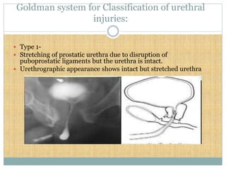 IVP by Dr.Anil.ppt