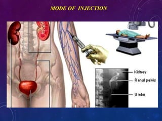 MODE OF INJECTION
 