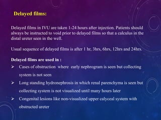Delayed films in IVU are taken 1-24 hours after injection. Patients should
always be instructed to void prior to delayed films so that a calculus in the
distal ureter seen in the well.
Usual sequence of delayed films is after 1 hr, 3hrs, 6hrs, 12hrs and 24hrs.
Delayed films are used in :
 Cases of obstruction where early nephrogram is seen but collecting
system is not seen
 Long standing hydronephrosis in which renal parenchyma is seen but
collecting system is not visualized until many hours later
 Congenital lesions like non-visualized upper calyceal system with
obstructed ureter
Delayed films:
 