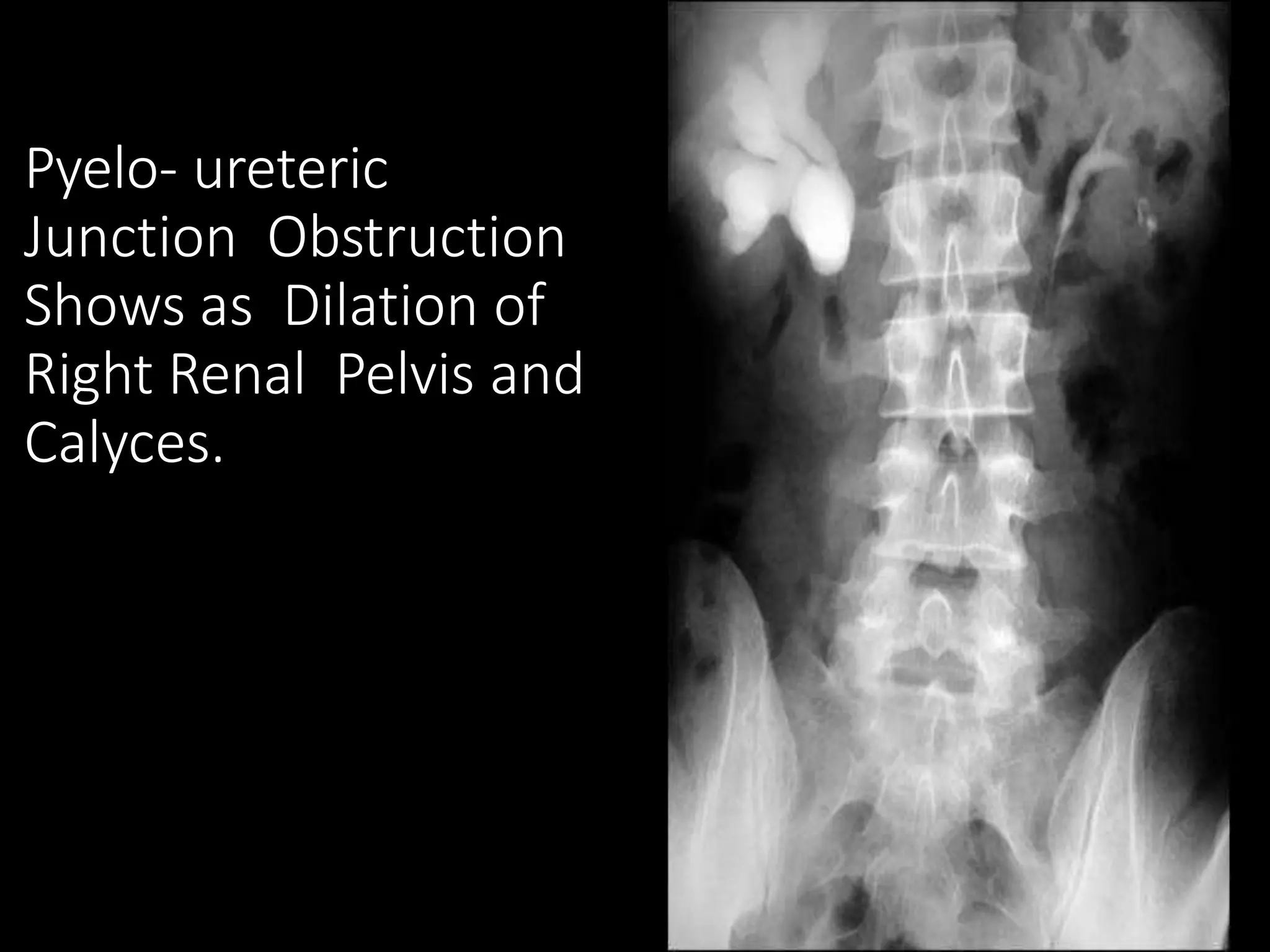IVP, RGU & MCU | PPTX