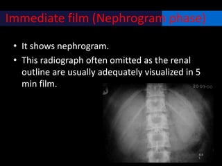 Immediate film (Nephrogram phase)
• It shows nephrogram.
• This radiograph often omitted as the renal
outline are usually adequately visualized in 5
min film.
 