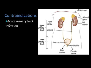 Contraindications
Acute urinarytract
infection
 