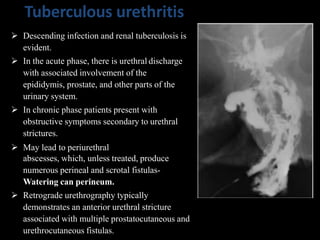 Tuberculous urethritis
 Descending infection and renal tuberculosis is
evident.
 In the acute phase, there is urethral discharge
with associated involvement of the
epididymis, prostate, and other parts of the
urinary system.
 In chronic phase patients present with
obstructive symptoms secondary to urethral
strictures.
 May lead to periurethral
abscesses, which, unless treated, produce
numerous perineal and scrotal fistulas-
Watering can perineum.
 Retrograde urethrography typically
demonstrates an anterior urethral stricture
associated with multiple prostatocutaneous and
urethrocutaneous fistulas.
 