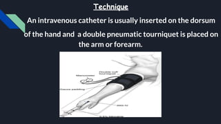 Intravenous Regional Anaesthesia (Bier Block) | PDF