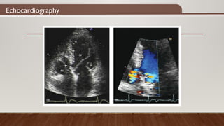 Echocardiography
 