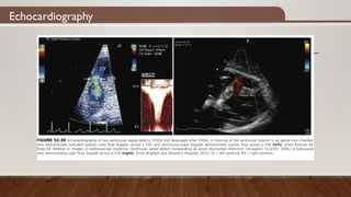 Echocardiography
 
