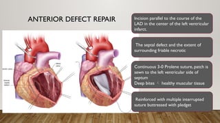 ANTERIOR DEFECT REPAIR Incision parallel to the course of the
LAD in the center of the left ventricular
infarct.
The septal defect and the extent of
surrounding friable necrotic
Continuous 3-0 Prolene suture, patch is
sewn to the left ventricular side of
septum
Deep bites  healthy muscular tissue
Reinforced with multiple interrupted
suture buttressed with pledget
 