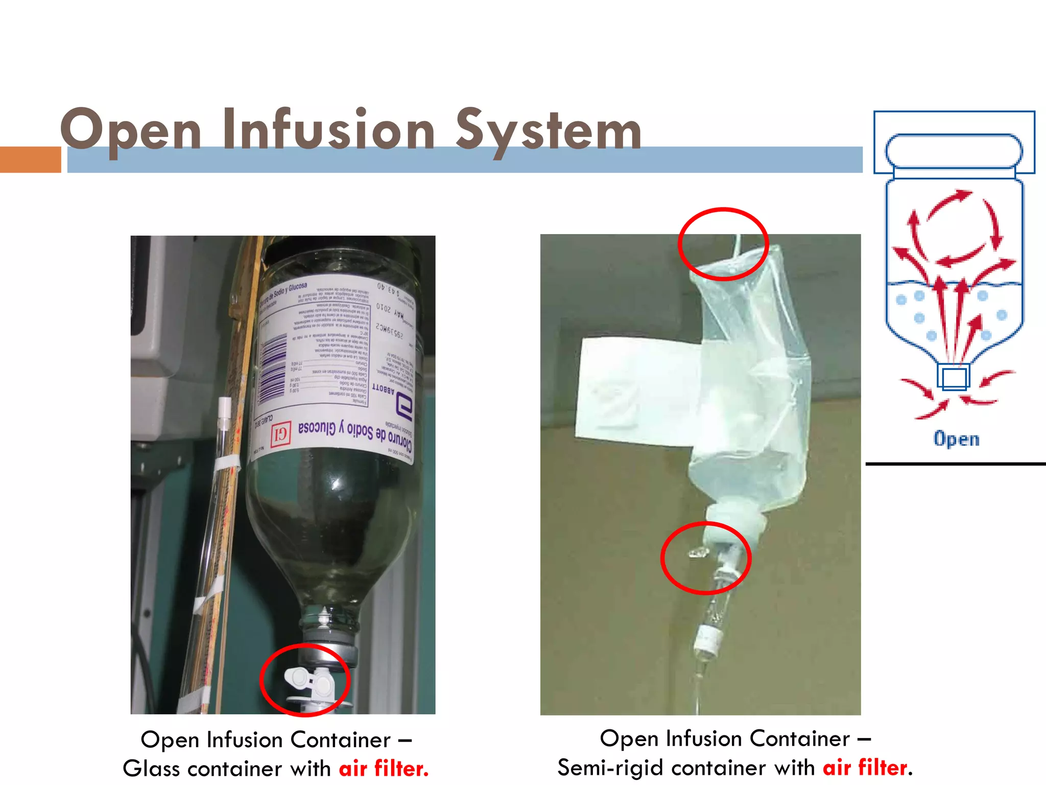 Open Infusion System




   Open Infusion Container –            Open Infusion Container –
  Glass container with air filter.   Semi-rigid container with air filter.
 
