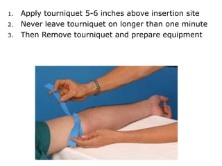 1. Apply tourniquet 5-6 inches above insertion site
2. Never leave tourniquet on longer than one minute
3. Then Remove tourniquet and prepare equipment
 