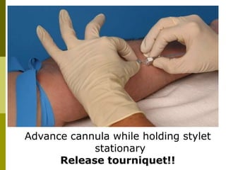 Advance cannula while holding stylet
stationary
Release tourniquet!!
 