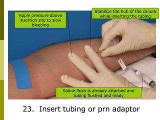 23. Insert tubing or prn adaptor
Apply pressure above
insertion site to slow
bleeding
Stabilize the hub of the canula
while inserting the tubing
Saline flush is already attached and
tubing flushed and ready
 