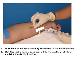 • Flush with saline to clear tubing and insure IV has not infiltrated.
3. Stabilize tubing with tape to prevent IV from pulling out while
applying the sterile dressing.
 