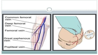 IV therapy, Type of IV fluids, Fluid calculation | PPTX