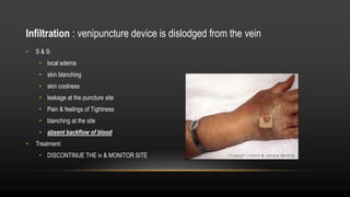IV .ppt