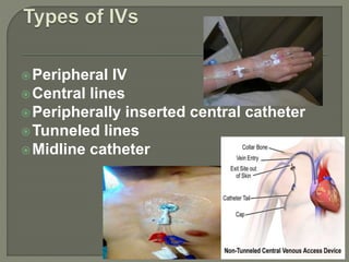 Peripheral IV
Central lines
Peripherally inserted central catheter
Tunneled lines
Midline catheter
 
