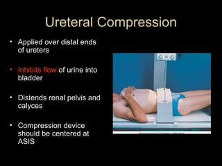 Ureteral Compression
• Applied over distal ends
of ureters
• Inhibits flow of urine into
bladder
• Distends renal pelvis and
calyces
• Compression device
should be centered at
ASIS

 