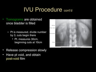 IVU Procedure cont’d
• Tomograms are obtained
once bladder is filled
– Pt is measured, divide number
by 3, cuts begin there
• Pt. measures 30cm,
beginning cuts at 10cm

• Release compression slowly
• Have pt void, and obtain
post-void film

 
