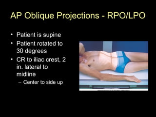 AP Oblique Projections - RPO/LPO
• Patient is supine
• Patient rotated to
30 degrees
• CR to iliac crest, 2
in. lateral to
midline
– Center to side up

 