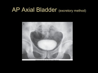 AP Axial Bladder (excretory method)

 
