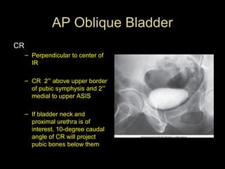 AP Oblique Bladder
CR
– Perpendicular to center of
IR
– CR 2′′ above upper border
of pubic symphysis and 2′′
medial to upper ASIS
– If bladder neck and
proximal urethra is of
interest, 10-degree caudal
angle of CR will project
pubic bones below them

 