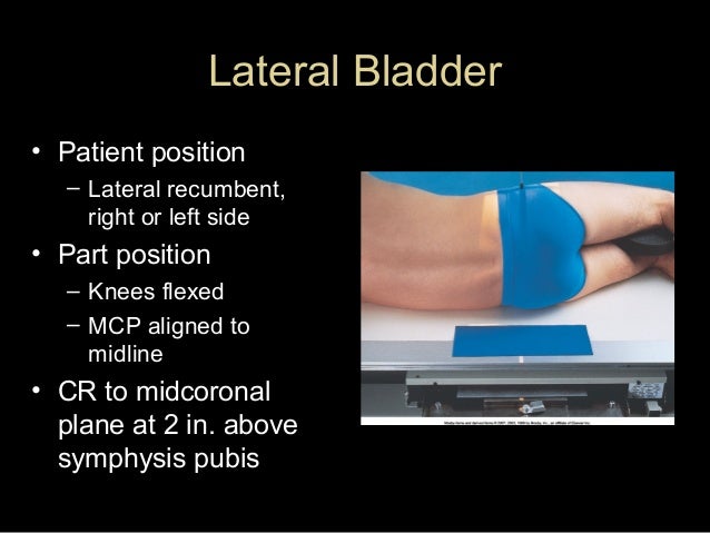 lateral recumbent position lateral recumbent position